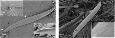 An Untargeted Metabolomic Approach for Microphytobenthic Biofilms in Intertidal Mudflats